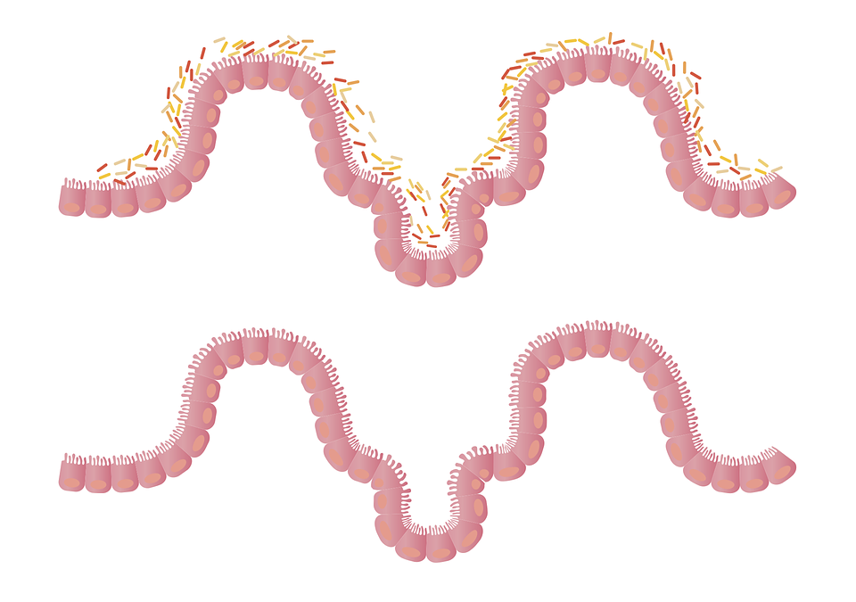 Modulation of the intestinal microbiome