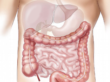 Intestinal microbiome